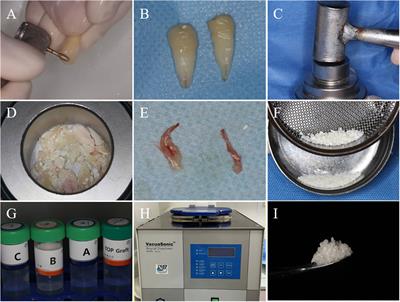 Demineralized dentin matrix promotes gingival healing in alveolar ridge preservation of premolars extracted for orthodontic reason: a split-mouth study